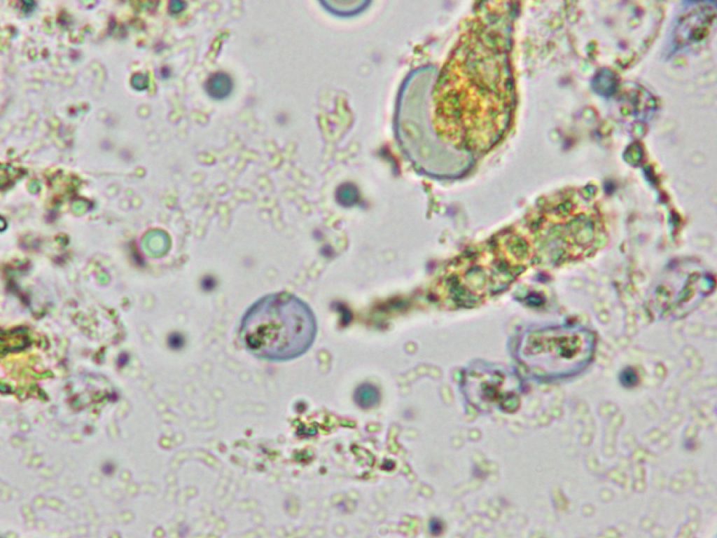 Indagine microscopica